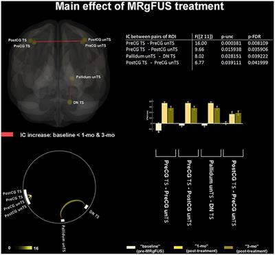 Resting State Functional Connectivity Signatures of MRgFUS Vim Thalamotomy in Parkinson's Disease: A Preliminary Study